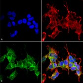Monoclonal Anti-Ankyrin G antibody produced in mouse clone S106-20, purified immunoglobulin