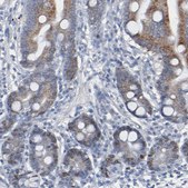 Anti-BIRC3 antibody produced in rabbit Prestige Antibodies&#174; Powered by Atlas Antibodies, affinity isolated antibody, buffered aqueous glycerol solution