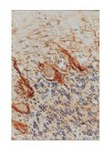 Neurofilament Antibodies Investigator Antibody Mini-Pack anti-neurofilament H&amp;M antibody, anti-neurofilament H antibody, and anti-neurofilament L antibody