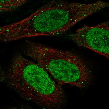 Anti-TDP1 antibody produced in rabbit Prestige Antibodies&#174; Powered by Atlas Antibodies, affinity isolated antibody