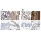 Anti-DYSF antibody produced in rabbit Prestige Antibodies&#174; Powered by Atlas Antibodies, affinity isolated antibody, buffered aqueous glycerol solution