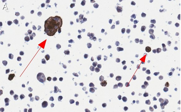 Anti-RSV Fusion Protein Antibody, clone 131-2A ZooMAb&#174; Mouse Monoclonal recombinant, expressed in HEK 293 cells