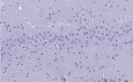 Anti-Synaptophysin Antibody, clone 2B21, ZooMAb&#174; Rabbit Monoclonal recombinant, expressed in HEK 293 cells