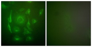 Anti-Keratin 7 antibody produced in rabbit affinity isolated antibody