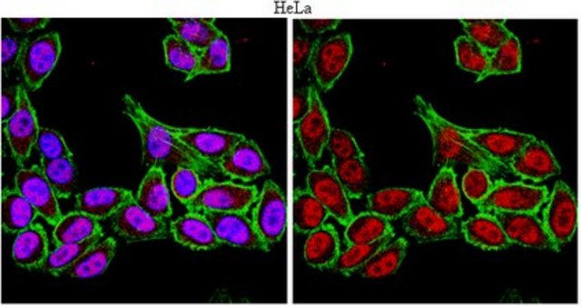 Anti-FoxP4 Antibody serum, from rabbit