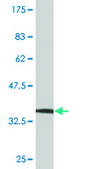 Monoclonal Anti-CHAT antibody produced in mouse clone 1H7, purified immunoglobulin, buffered aqueous solution