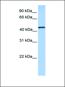 Anti-TRMT11 antibody produced in rabbit affinity isolated antibody