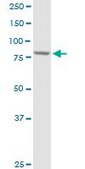 Anti-PFKP antibody produced in rabbit purified immunoglobulin, buffered aqueous solution