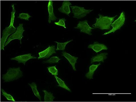 Monoclonal Anti-MR1 antibody produced in mouse clone 5B5, purified immunoglobulin, buffered aqueous solution