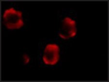Anti-IRAK-2 antibody produced in rabbit affinity isolated antibody, buffered aqueous solution