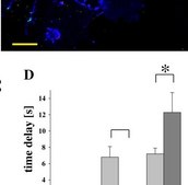 Anticorps monoclonal de souris anti-&#945;-actine de muscle lisse-Cy3&#8482; clone 1A4, purified from hybridoma cell culture