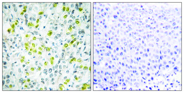 Anti-CHD4 antibody produced in rabbit affinity isolated antibody