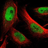 Anti-GATA2 antibody produced in rabbit Prestige Antibodies&#174; Powered by Atlas Antibodies, affinity isolated antibody, buffered aqueous glycerol solution