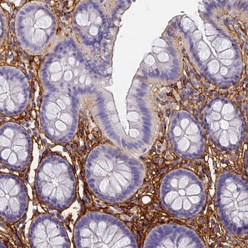 Anti-ITIH1 antibody produced in rabbit Prestige Antibodies&#174; Powered by Atlas Antibodies, affinity isolated antibody, buffered aqueous glycerol solution