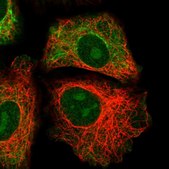 Anti-GRAMD1B antibody produced in rabbit Prestige Antibodies&#174; Powered by Atlas Antibodies, affinity isolated antibody, buffered aqueous glycerol solution
