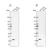 Anti-MZB1 antibody produced in rabbit Prestige Antibodies&#174; Powered by Atlas Antibodies, affinity isolated antibody, buffered aqueous glycerol solution