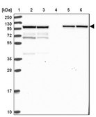 Anti-KLC1 antibody produced in rabbit Prestige Antibodies&#174; Powered by Atlas Antibodies, affinity isolated antibody, buffered aqueous glycerol solution
