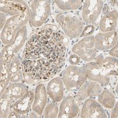 Anti-IKBKG antibody produced in rabbit Prestige Antibodies&#174; Powered by Atlas Antibodies, affinity isolated antibody, buffered aqueous glycerol solution