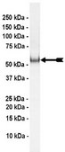 Parkin (c-Myc tagged) Protein, active, 10 &#181;g Active, full length, recombinant human Parkin. N-terminal c-Myc, 6His-tagged. For use in Enzyme Assays. Functions as an E3 ligase in ubiquitination assays.