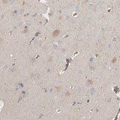Anti-C9orf72 antibody produced in rabbit Prestige Antibodies&#174; Powered by Atlas Antibodies, affinity isolated antibody, buffered aqueous glycerol solution