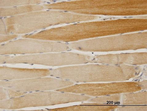 Anti-ALKBH1 antibody produced in mouse purified immunoglobulin, buffered aqueous solution