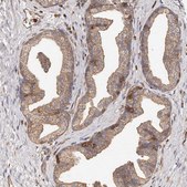 Anti-CAP1 antibody produced in rabbit Prestige Antibodies&#174; Powered by Atlas Antibodies, affinity isolated antibody, buffered aqueous glycerol solution