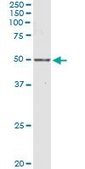 Anti-NR1I2 antibody produced in mouse purified immunoglobulin, buffered aqueous solution