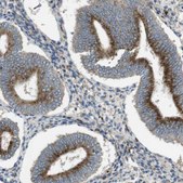 Anti-LAMP1 antibody produced in rabbit Prestige Antibodies&#174; Powered by Atlas Antibodies, affinity isolated antibody, buffered aqueous glycerol solution