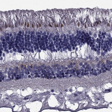 Anti-COL9A1 antibody produced in rabbit Prestige Antibodies&#174; Powered by Atlas Antibodies, affinity isolated antibody