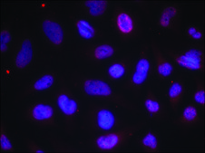 Anti-phospho-MEF2A (pThr312) antibody produced in rabbit affinity isolated antibody