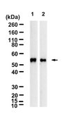 Anti-GSDME/DFN5 Antibody, clone 1H7 ZooMAb&#174; Rabbit Monoclonal recombinant, expressed in HEK 293 cells