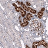 Monoclonal Anti-CHI3L1 antibody produced in mouse Prestige Antibodies&#174; Powered by Atlas Antibodies, clone CL12314, purified immunoglobulin, buffered aqueous glycerol solution