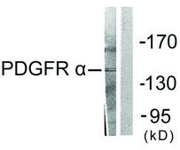 Anti-PDGFR &#945; antibody produced in rabbit affinity isolated antibody