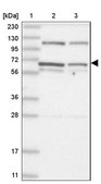 Anti-DIS3L2 antibody produced in rabbit Prestige Antibodies&#174; Powered by Atlas Antibodies, affinity isolated antibody, buffered aqueous glycerol solution