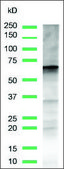 Anti-Glypican-3 antibody, Rabbit monoclonal clone SP86, recombinant, expressed in proprietary host, affinity isolated antibody