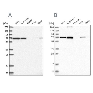 Anti-AGPS antibody produced in rabbit Prestige Antibodies&#174; Powered by Atlas Antibodies, affinity isolated antibody, buffered aqueous glycerol solution, ab2