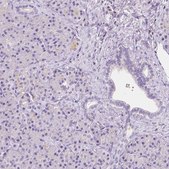 Anti-GABRD antibody produced in rabbit Prestige Antibodies&#174; Powered by Atlas Antibodies, affinity isolated antibody, buffered aqueous glycerol solution
