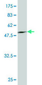Monoclonal Anti-PSPH antibody produced in mouse clone 3A5, purified immunoglobulin, buffered aqueous solution