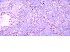 Anti-Casein Kinase 2&#945; Antibody, 1AD9 clone 1AD9, from mouse