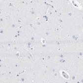 Anti-CD180 antibody produced in rabbit Prestige Antibodies&#174; Powered by Atlas Antibodies, affinity isolated antibody, buffered aqueous glycerol solution