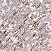 Anti-TK2 antibody produced in rabbit Prestige Antibodies&#174; Powered by Atlas Antibodies, affinity isolated antibody, buffered aqueous glycerol solution