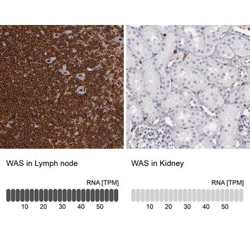 Anti-WAS antibody produced in rabbit Prestige Antibodies&#174; Powered by Atlas Antibodies, affinity isolated antibody, buffered aqueous glycerol solution