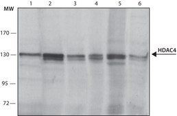 Anti-Histone Deacetylase 4 (HDAC4) antibody, Mouse monoclonal clone HDAC4-144, purified from hybridoma cell culture
