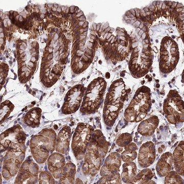 Anti-LSM6 antibody produced in rabbit Prestige Antibodies&#174; Powered by Atlas Antibodies, affinity isolated antibody, buffered aqueous glycerol solution