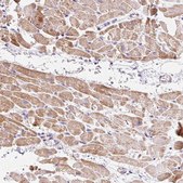 Anti-IMMT antibody produced in rabbit Prestige Antibodies&#174; Powered by Atlas Antibodies, affinity isolated antibody, buffered aqueous glycerol solution