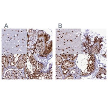 Anti-DDX1 antibody produced in rabbit Prestige Antibodies&#174; Powered by Atlas Antibodies, affinity isolated antibody, buffered aqueous glycerol solution