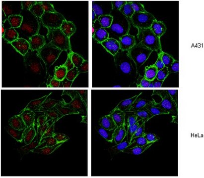 Anti-Histone H2B Antibody, clone 5HH2-2A8 ascites fluid, clone 5HH2-2A8, from mouse