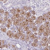 Anti-AQP5 antibody produced in rabbit Prestige Antibodies&#174; Powered by Atlas Antibodies, affinity isolated antibody, buffered aqueous glycerol solution