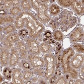 Anti-TNMD antibody produced in rabbit Prestige Antibodies&#174; Powered by Atlas Antibodies, affinity isolated antibody, buffered aqueous glycerol solution