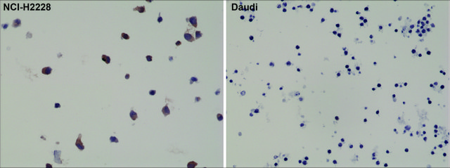 Anti-ALK antibody, Rabbit monoclonal recombinant, expressed in HEK 293 cells, clone RM361, purified immunoglobulin